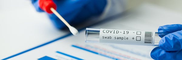 About our COVID-19 PCR test at home